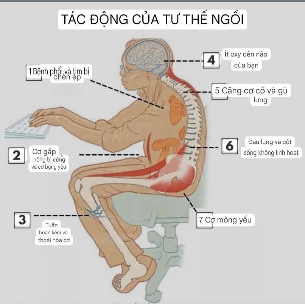 Phòng ngừa bệnh văn phòng với tư thế làm việc chuẩn công thái học Phòng ngừa bệnh văn phòng với tư thế làm việc chuẩn công thái học